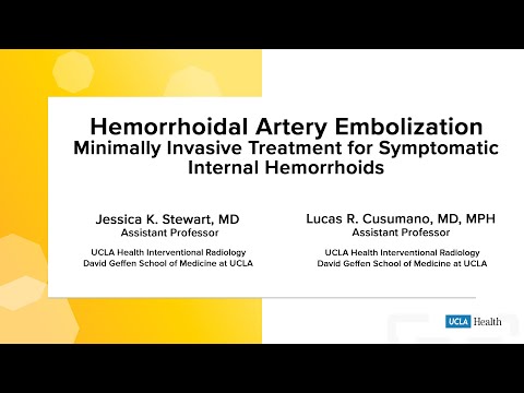 Hemorrhoidal Artery Embolization Minimally Invasive Treatment for Symptomatic Internal Hemorrhoids