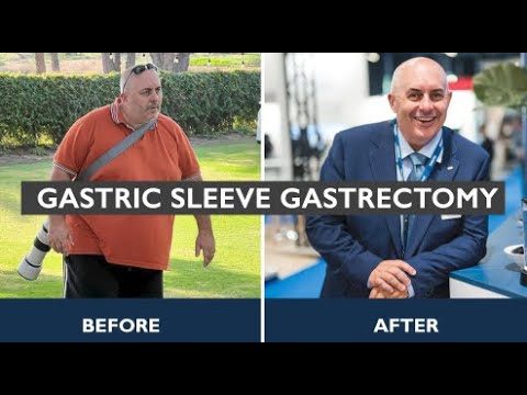 Bariatric Surgery in Dubai | Patient Testimony | Gastric Sleeve Surgery in Dubai | Dr Ahmed Hassan