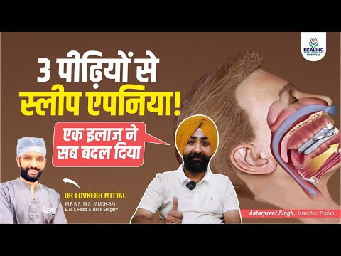 Life-changing Sleep Apnea Surgery by Dr. Lovkesh Mittal | Successful Treatment for Sleep Apnea