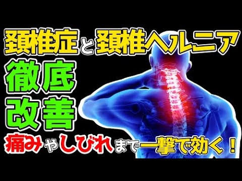 【一撃で変わる】頚椎症と頚椎ヘルニアを徹底改善【永久保存版】