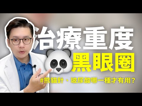 【熊貓針Q&A】4種黑眼圈的類型對症下藥！熊貓針、玻尿酸哪一種才有用？治療黑眼圈最好的方式大部分人都做不到！睡不飽人的救星