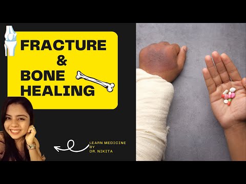 Fracture and Bone Healing (Skeletal System Part 2) by Dr. Nikita