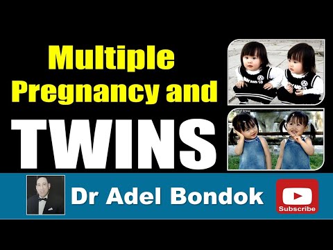 Types of Twins: Identical and Fraternal, Dr Adel Bondok