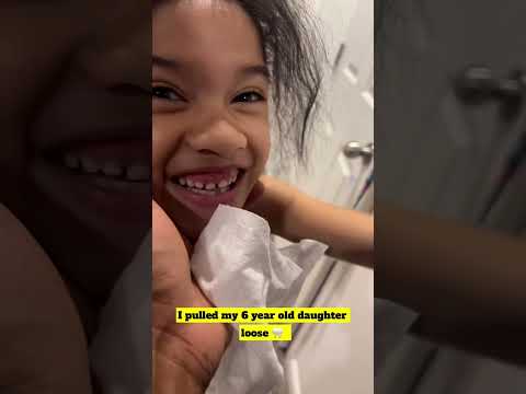 Her tooth fell out 🦷 😳 #shorts #family #funny