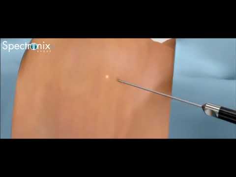 SmartSculpt video