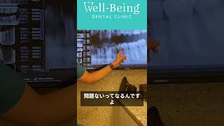 歯科検診【歯医者の全体診査②】咬翼法で虫歯を見つける