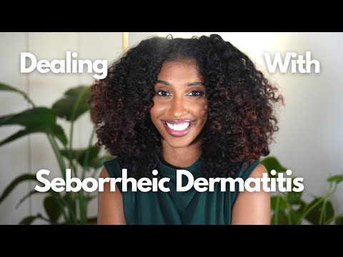 dealing with seborrheic dermatitis...