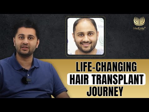 The Truth Behind the Transformation | Hair Transplant Success | MedLinks