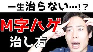 【必見】M字ハゲ、前髪ハゲは治るの？どう対策するべきか解説します。