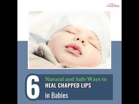 Best Home Remedies for Chapped Lips In Babies | Remedies for Dry Lips In Babies