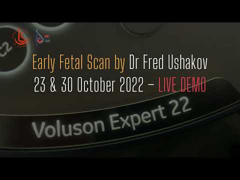 Dr Fred Ushakov - Early Fetal Scan Live DEMO - VOLUSON Expert 22