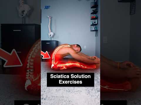 3-Step Sciatica Solution!