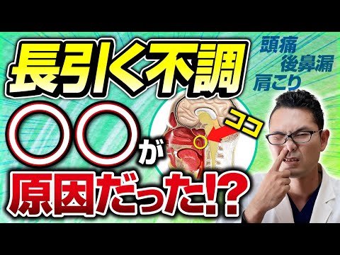 【耳鼻科医解説】長引く体調不良の原因「上咽頭炎」を解説【Bスポット治療実演】