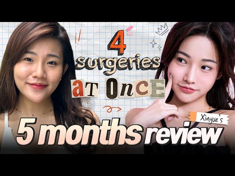 Having 4 surgeries at ONCE! 😍 | Xinyue's PLASTIC SURGERY journey at BRAUN✨ (Part 2)