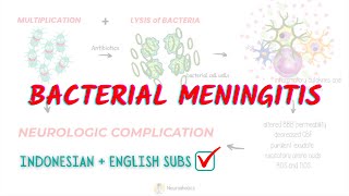 Bacterial meningitis CNS Infection | Neuroaholics