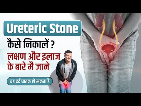 Ureteric Stone in Hindi - Symptoms, Management-Treatment, Pain x-rays | Ureteric Stone kaise nikale