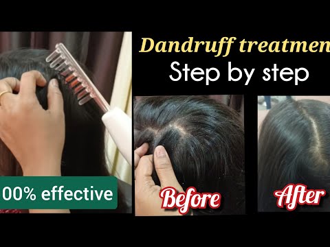 High frequency dandruff treatment tamil 💥// dandruff treatment professional//dandruff treatment