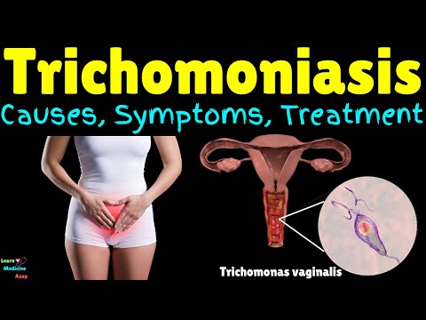 Trichomoniasis: Causes, Symptoms, Diagnosis, Treatment, Complications & Prevention