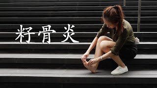 《籽骨炎》你知多少？