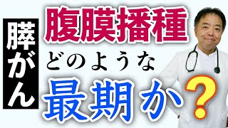 膵がん腹膜播種どんな最期を迎えるのか？質問回答#39