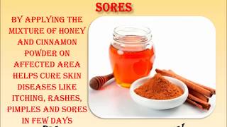 Natural Health Tips For Pimples, Indigestion, Itching and Burns