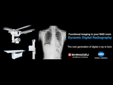 Dynamic Digital Radiography introduction movie