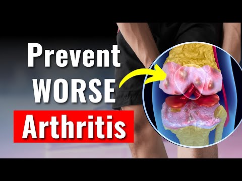 3 Proven Ways To Prevent Knee Arthritis From Getting Worse