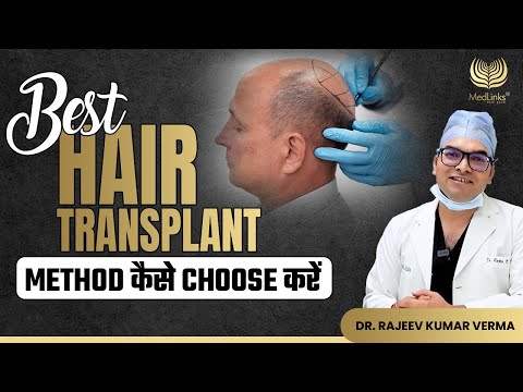 Best Hair Transplant Method कैसे Choose करें | Different Types of Hair Transplants | MedLinks