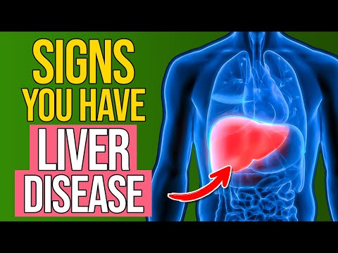 15 Warning Signs You May Have Liver Disease