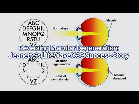 Reversing Macular Degeneration: Jeanette’s LifeWave X39 Success Story