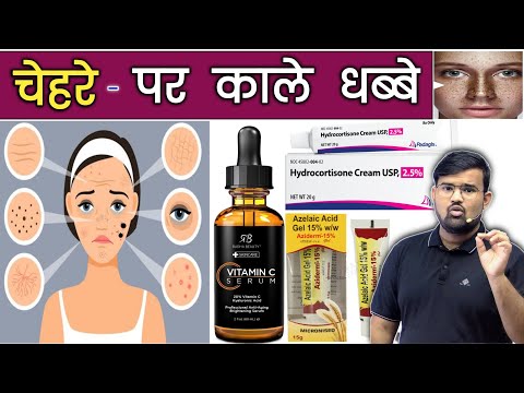 Melasma - चेहरे पर काले धब्बे | Medicine | Treatment | Doctor | Pharmacy | Nursing | MBBS | BHMS