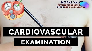 Cardiovascular Examination | OSCE Guide | UKMLA | CPSA | PLAB 2