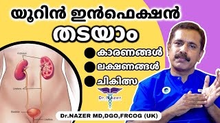 URINE INFECTION (UTI) MALAYALAM |യൂറിൻ ഇൻഫെക്ഷൻ തടയാം |  ലക്ഷണങ്ങൾ, കാരണങ്ങൾ, ചികിത്സ | Dr Nazer