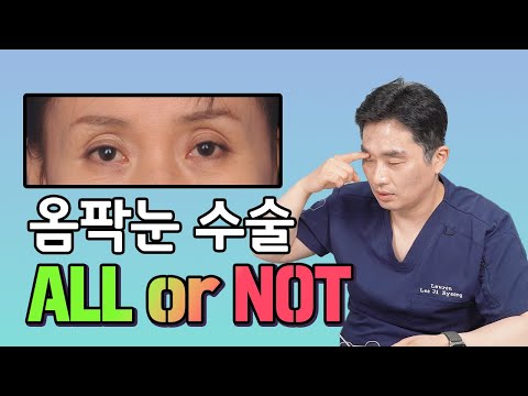 옴팍눈 수술 방법? ALL or NOT