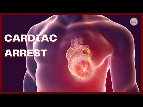 CARDIAC ARREST #heartdisease #healthcare #heartattack #cardiacarrest #CPR #suddencardiacarrest #ecg