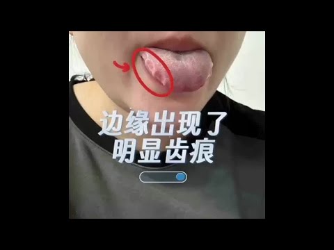 你的舌头也是这样吗