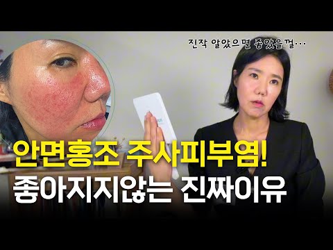 안면홍조 주사피부염이 있다면 반드시 피해야할 행동 5가지