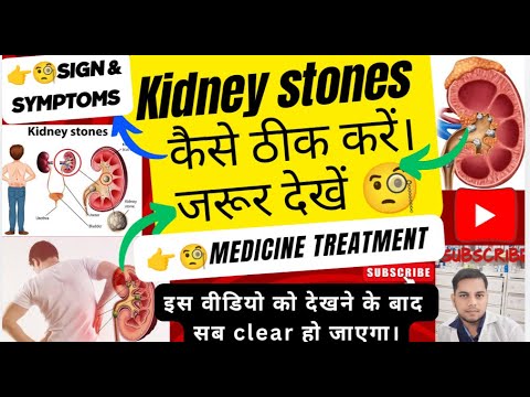 kidney stone कैसे ठीक करें | causes | कारण | sign and symptoms | prevention | diagnosis | treatments