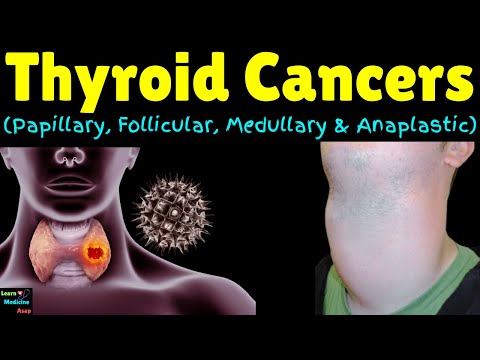 Thyroid Cancers (Papillary, Follicular, Medullary & Anaplastic) | Classification of Thyroid Neoplasm