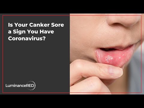 Is Your Canker Sore a Sign You Have Coronavirus?