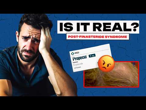 Is Post Finasteride Syndrome Real or Not?