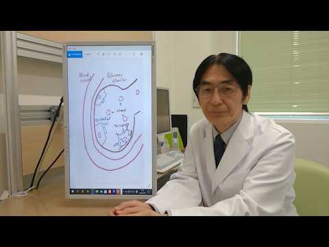 ARDSに進行すると致命的