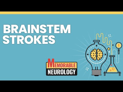 Brainstem Stroke Mnemonics (Memorable Neurology Lecture 15)