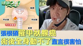 張根碩罹甲狀腺癌 術後全身動不了直言很害怕 健康2.0  @tvbshealth20