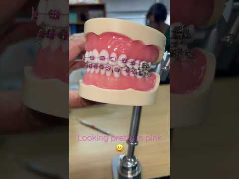 How to add dental elastic band? #shortsviral #howto #dentalassistant #dentalcare #ortho #SJVC #oral