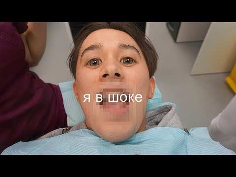 МНЕ СНЯЛИ БРЕКЕТЫ ! (реакция друзей 😭)