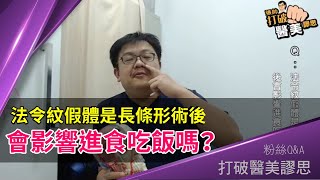 假體法令紋的迷思（Part 2）法令紋假體是長條形，術後會影響進食吃飯嗎？ 打破醫美謬思 75-20180221