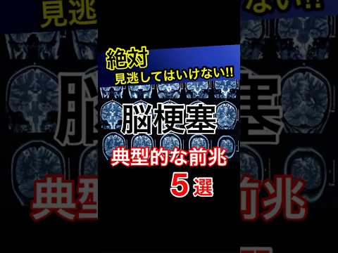 見逃してはいけない脳梗塞の初期症状5選！#健康#予防医学#雑学#脳梗塞