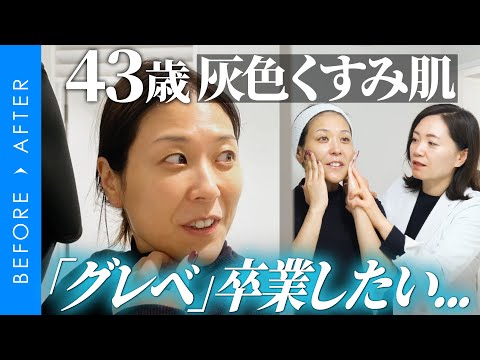 ビフォアフ：43歳くすみ「グレベ肌」が輝き出すまで。プロ監修美肌ストーリー【前編】