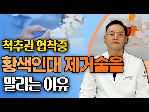 황색인대 제거술 쉽게 결정하면 안 된다? - 제애 정형외과 서희수 원장 8회 #협착증 #다리저림 #허리수술